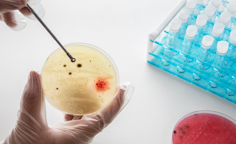 Immunohistochemistry Market