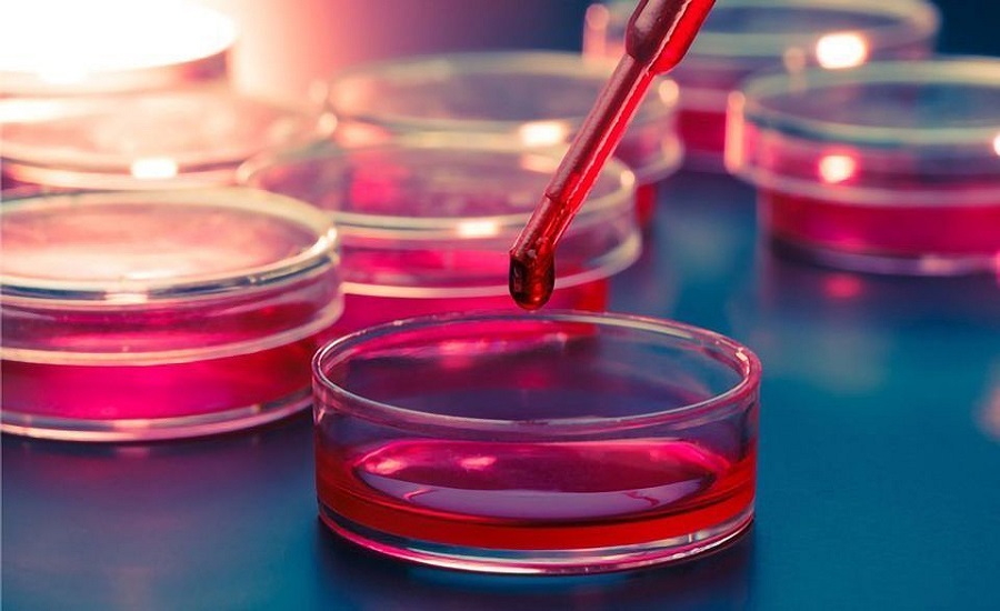 Cell Culture Market