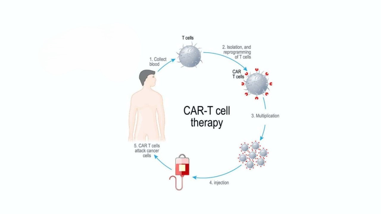 CAR T-Cell Therapy Market