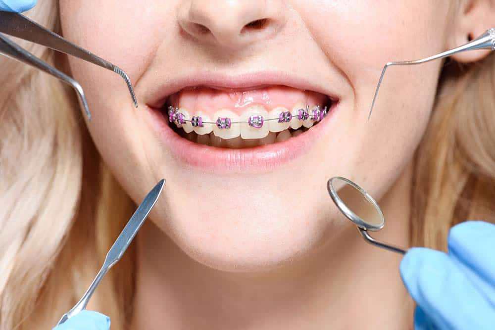 Orthodontics Market