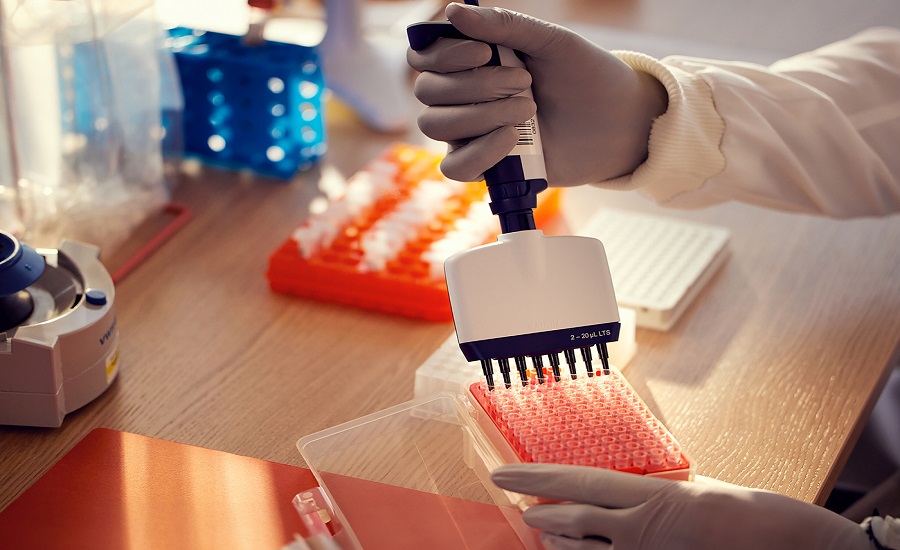 Sample Preparation Market