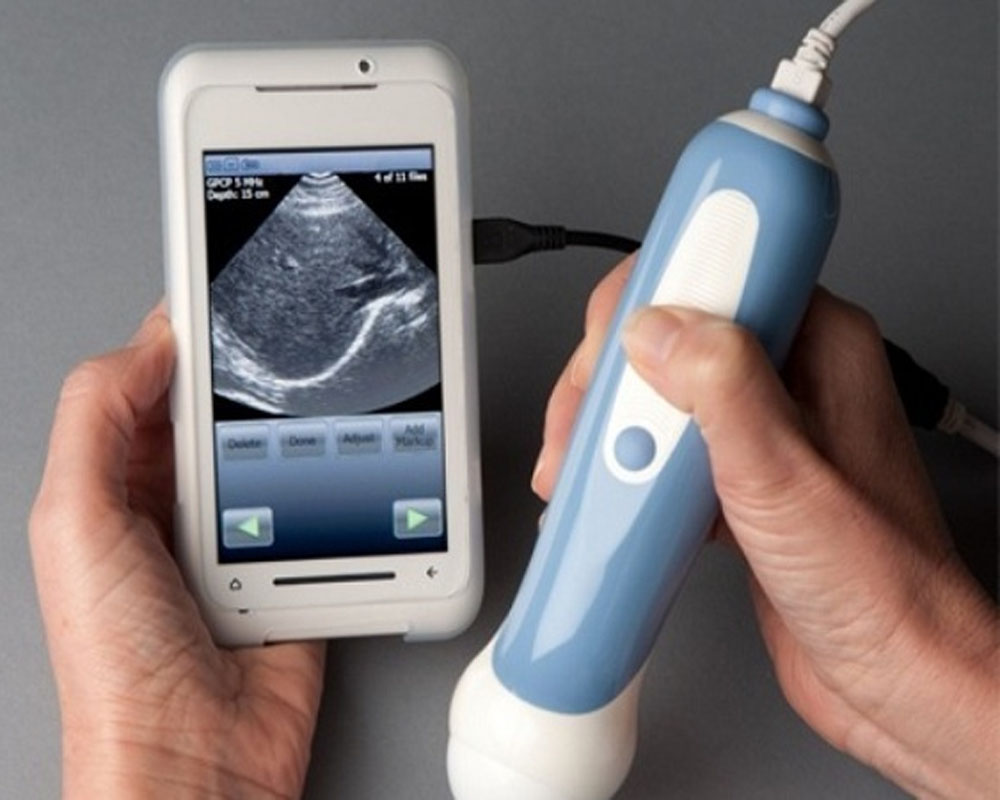 Ultrasound Devices Market